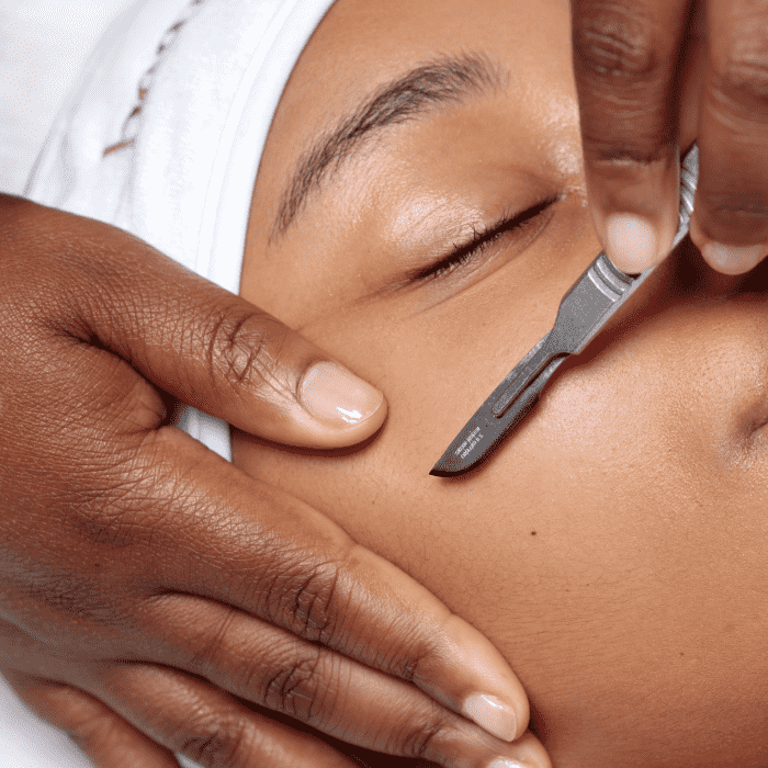 Le dermaplaning + soin profond